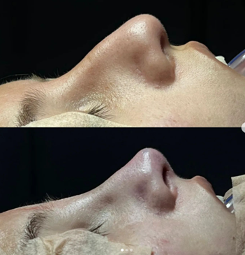 Slider image (4) Dr. Juan Sanabria Plastic Surgeon